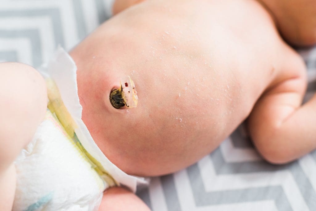 newborn belly button
